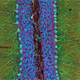 Illustration for article titled The Astounding And Horrific World As Seen Under A Microscope